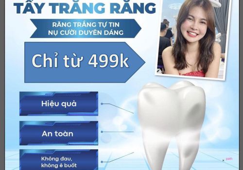 Tẩy trắng răng cho khách hàng tại Vindental
